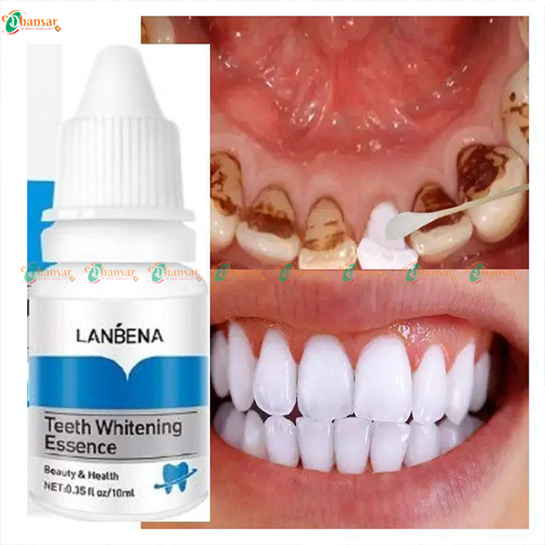 Original Teeth Whitening Liquid