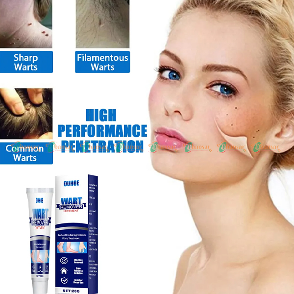 Wart Remover Ointment | Medical Ointment for Skin Tag and Foot Corn